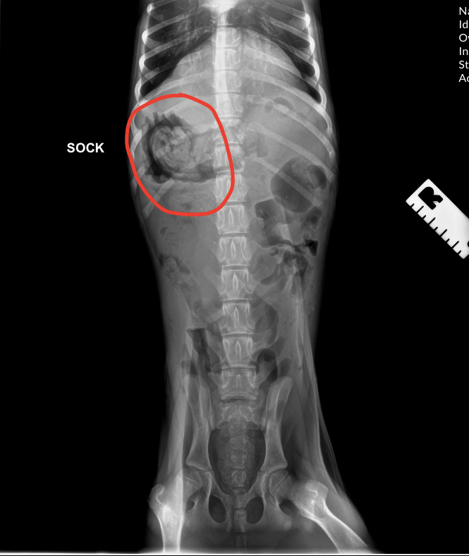 x-ray of a dog that ate a sock