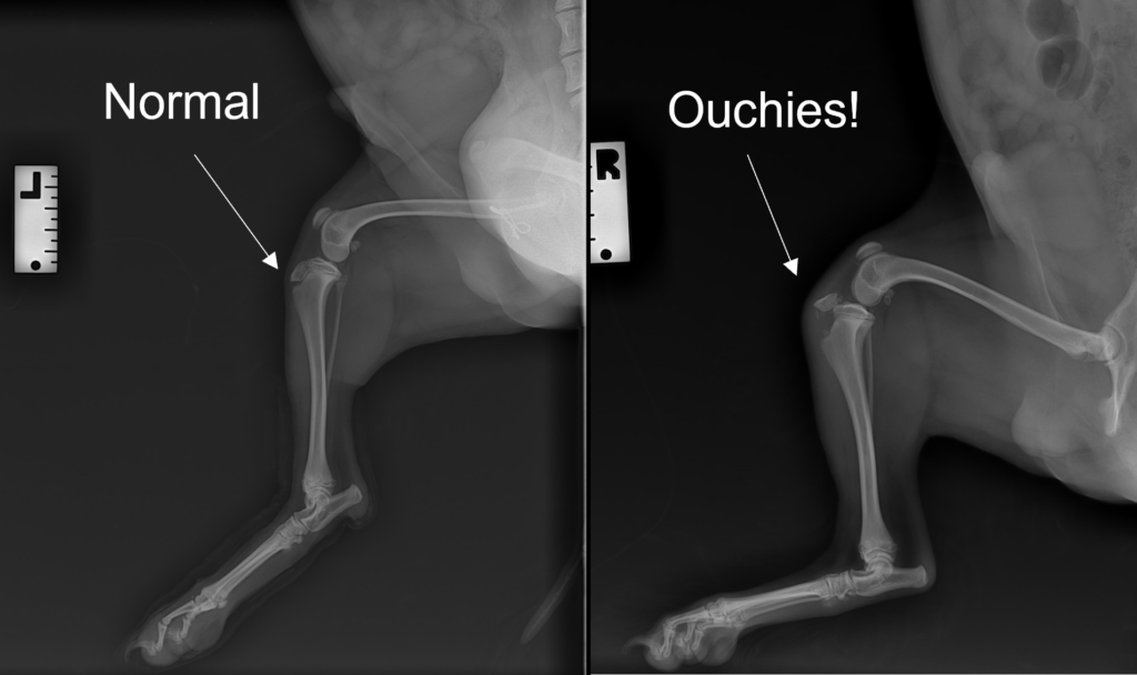A X-ray of a tibial tuberosity