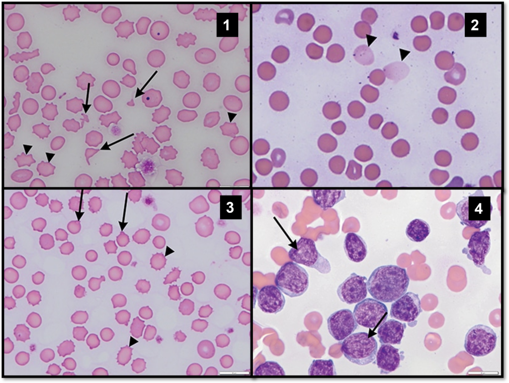 The blood results of an animal with immune-mediated hemolytic anemia