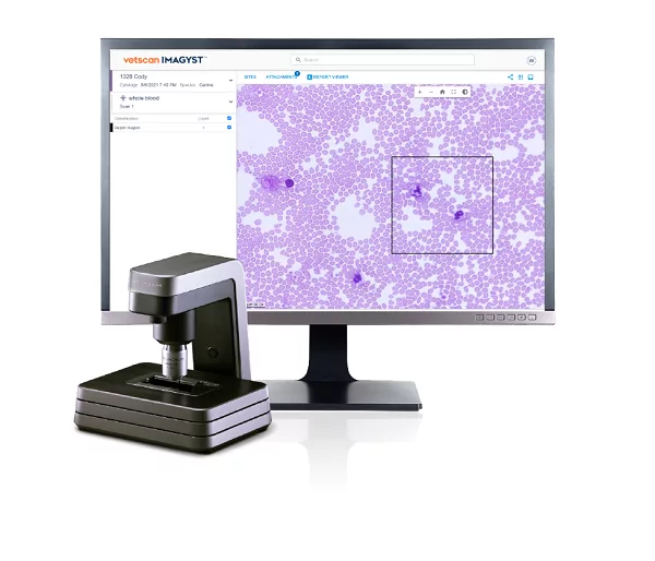 Blood test results under analysis